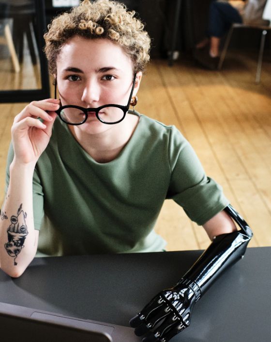 Mujer joven con prótesis en el brazo izquierdo trabajando delante de un portátil